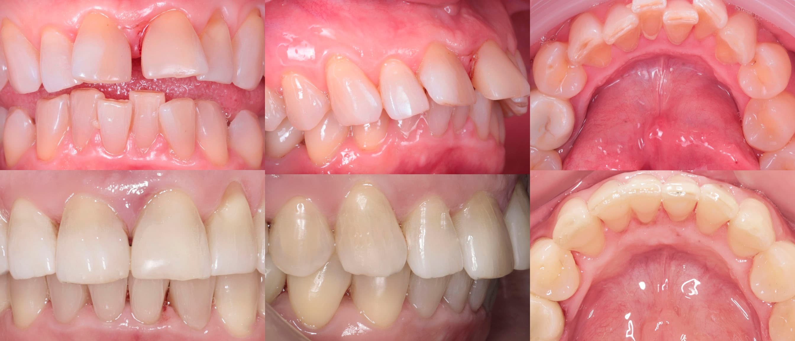 Клинический случай 1